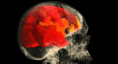 L'orgasme féminin visible grâce au scanner